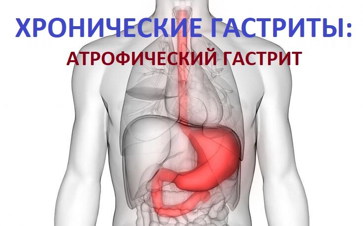 Атрофический гастрит эндоскопическая картина