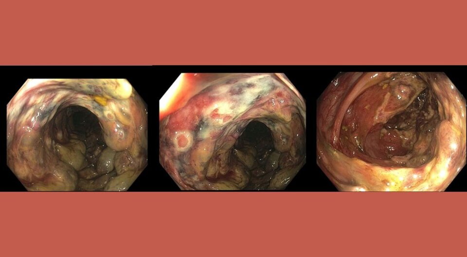   Aleem Azal Ali et al. / BMJ Case Reports, 2023