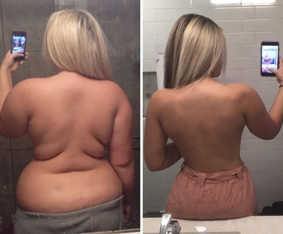 Невероятный результат. Спина до и после похудения. Складки на спине до и после. Похудение до и после.