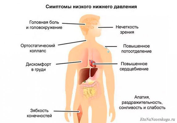 Симптомы низкого давления