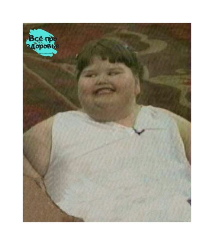 Толстая девочка 12. Самый жирный ребенок в мире.