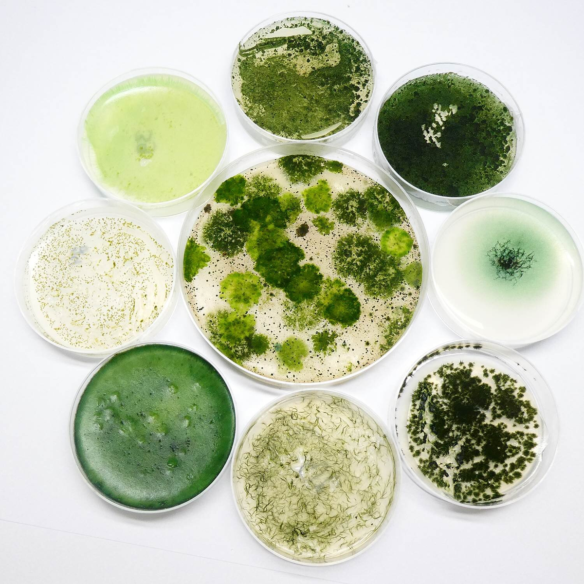 Синезелёные водоросли цианобактерии. Колониальные цианобактерии. Колотрикс цианобактерия. Цианобактерия это водоросль.