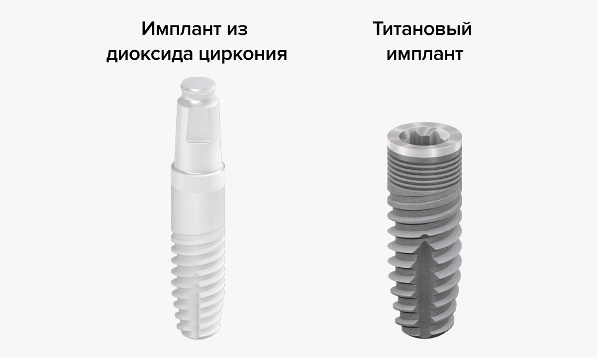 Циркониевые импланты зубов | Журнал Startsmile о стоматологии | Дзен
