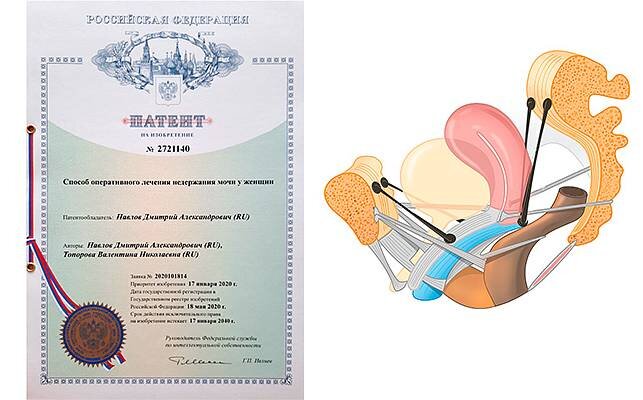Патент на авторскую методику