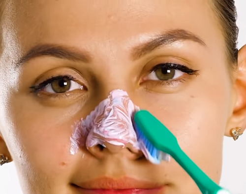 Черные точки на носу: как избавиться в домашних условиях
