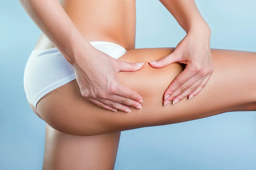 Боремся с целюлитом дома