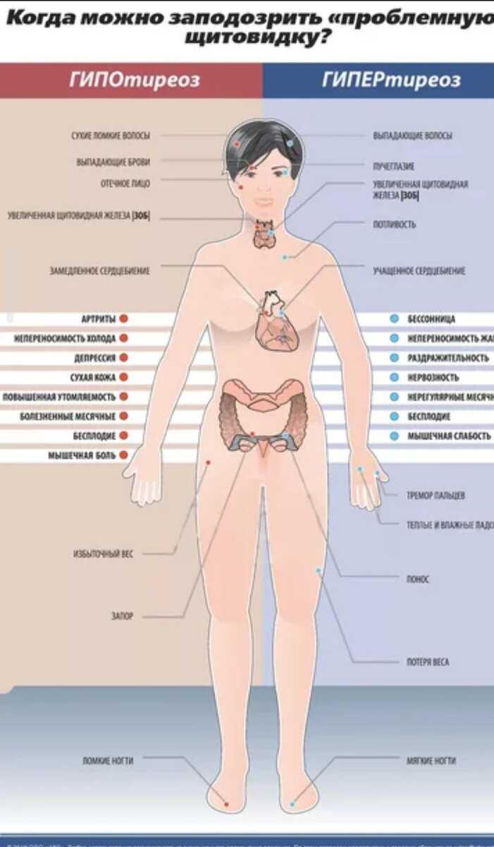 Щитовидная железа. Мой личный опыт. Часть 2. Последствия болезни. | Село  асфальтированное | Дзен