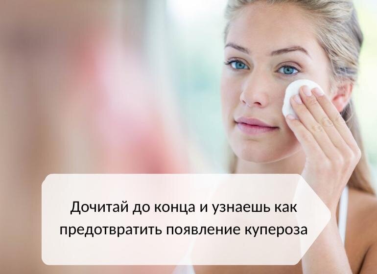 Купероз на лице