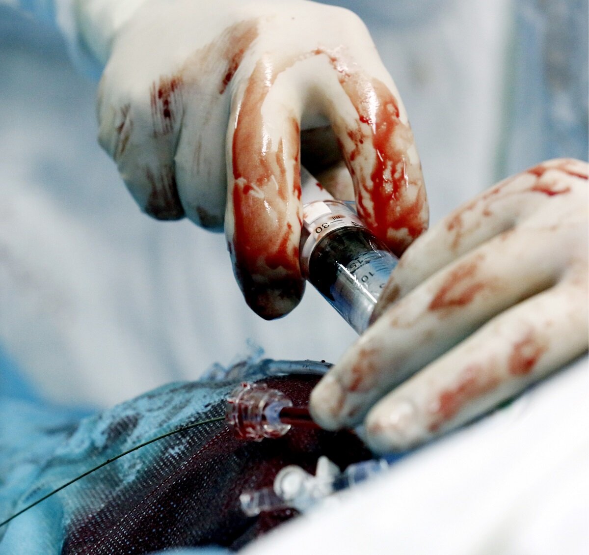 Валерий Матыцин/ТАСС