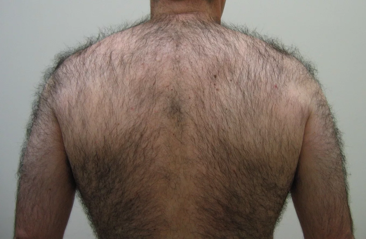 не волосатая грудь у мужчин фото 116