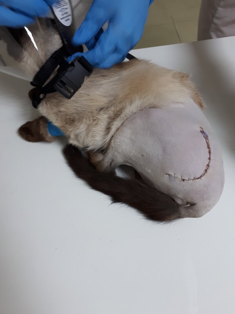 Таз собрали на спицы, которые теперь навсегда будут у Симы внутри