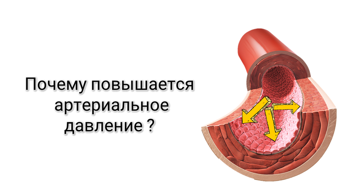 повышенное артериальное давление
