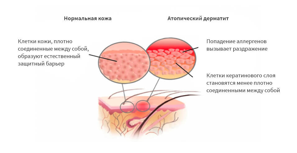 Лечение атопического дерматита у собак схема