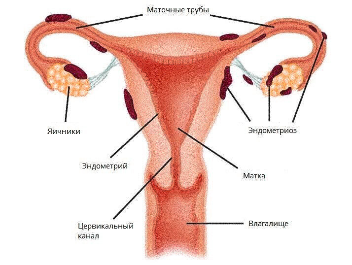 Такие очаги с каждым месяцем увеличиваются, нарастая друг на друга, ведь выйти естественным путём им некуда.