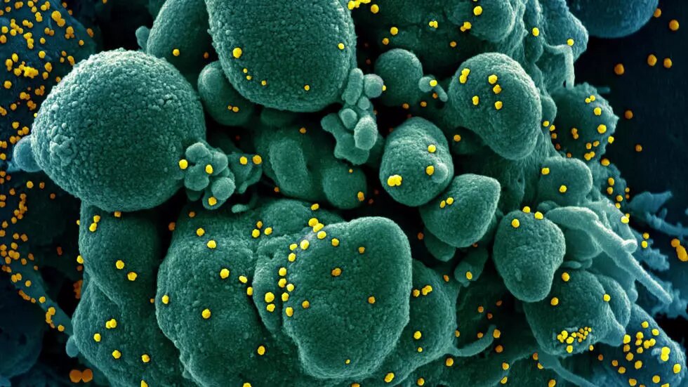 Ссылка: https://www.france24.com/en/20200328-can-the-coronavirus-infect-someone-twice