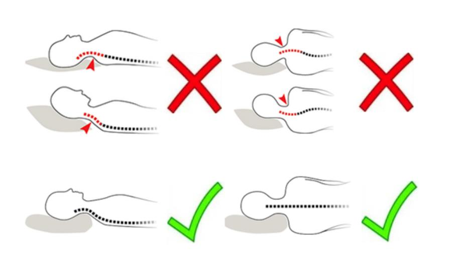 Как правильно спать на подушке. Позы для сна при остеохондрозе шейного отдела. Как правильно спать правильное положение подушки. Правильные позы для сна при остеохондрозе. Неправильное положение головы на подушке во время сна.