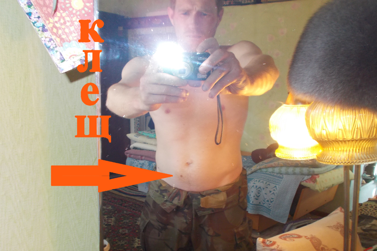 Клещ на животе.