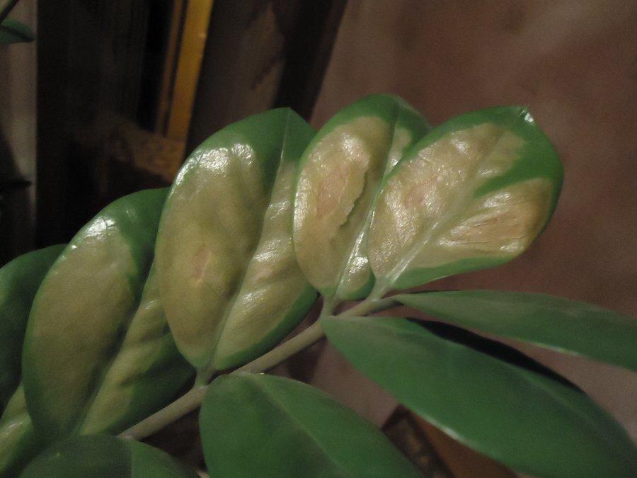 Солнечный ожог