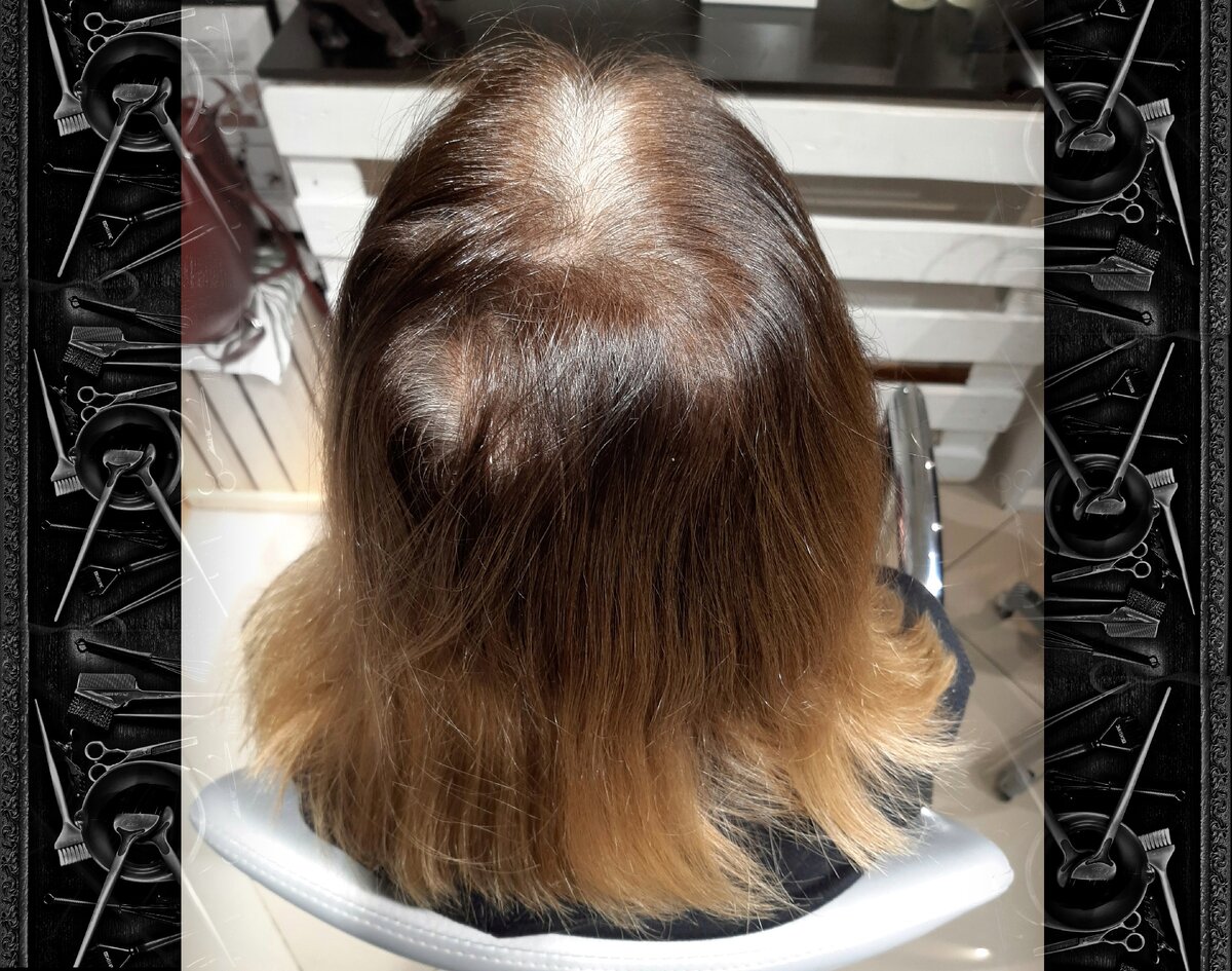 Сильная седина у корней