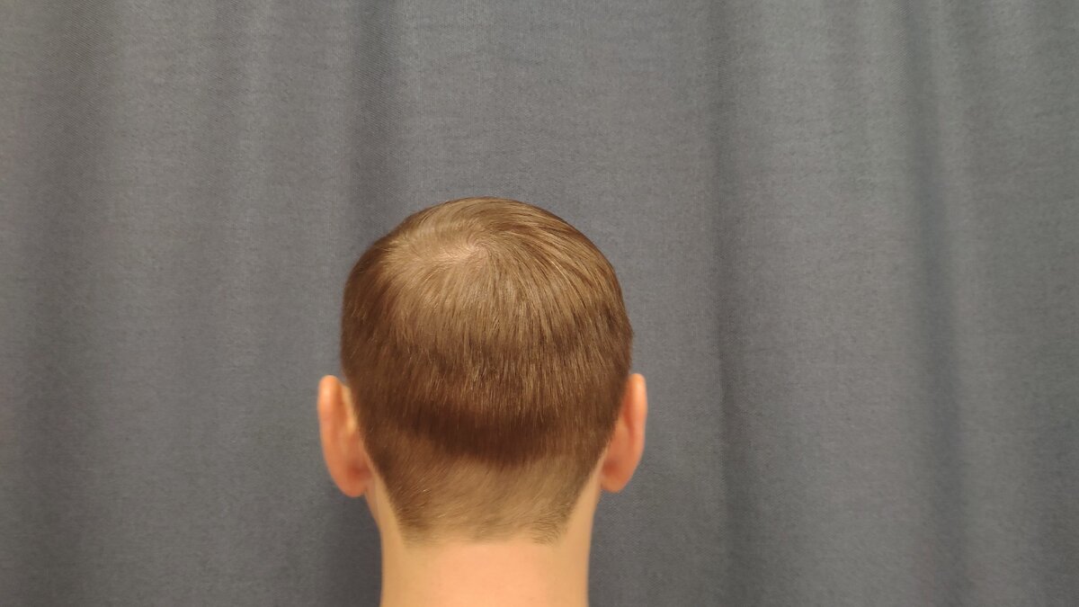 Мой вид сзади после стрижки, спустя пол дня