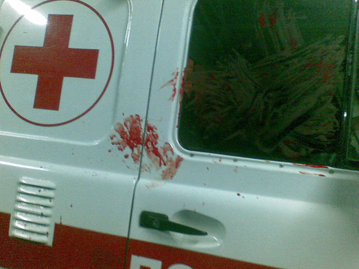 Фото из моего архива. Сделано уже на санобработке. Как раз с того вызова. 