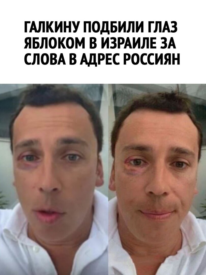 Многие наши элиты, покинувшие Россию после 24 февраля, выбрали «темную» сторону медали...