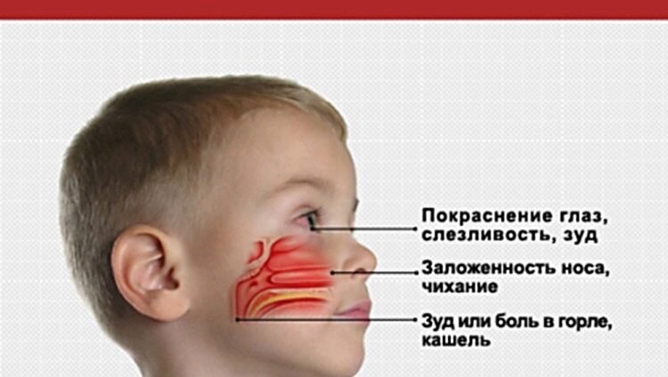 Сопли у ребенка — лечение по методам доктора Комаровского