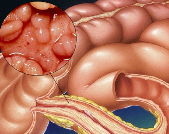 При сбалансированной диете дефицит меди встречается относительно редко