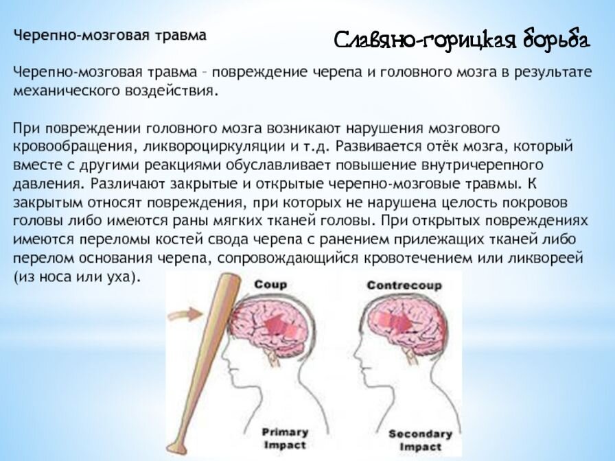 Как люди выглядят после чмт тяжело