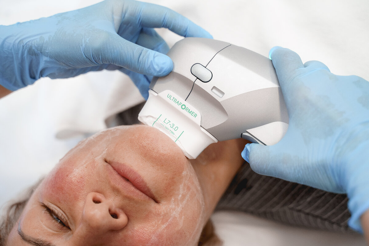 клату Эссенти анапа