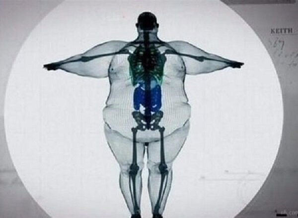 🖤💙"У меня кость широкая". Зависит ли вес от генетики? Три типа телосложения. Индекс Соловьёва