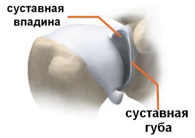 Вывих плеча: как распознать и вылечить