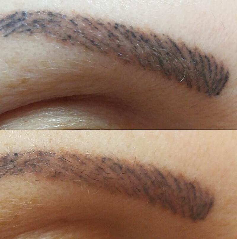 Неудачный микроблейдинг