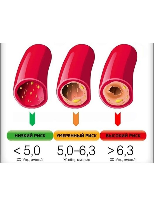 Мифы про холестерин. Надо ли на самом деле его снижать и кому и насколько