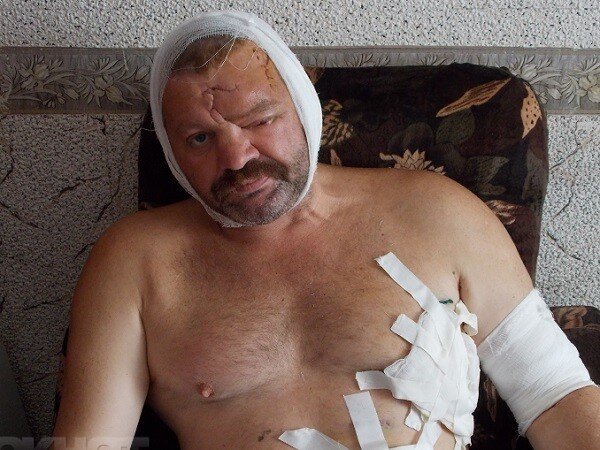 Игорь Ворожбицын — "выживший" после нападения медведя