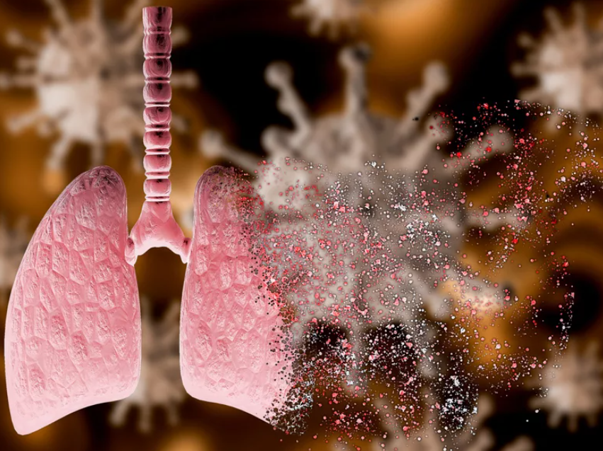 Картинка из интернета. Очень хочется скорее вернуться к нормальной жизни и дышать полной грудью.