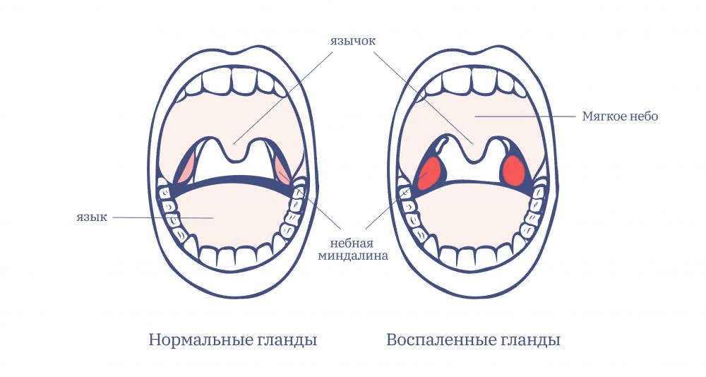 Строение миндалин схема у взрослых