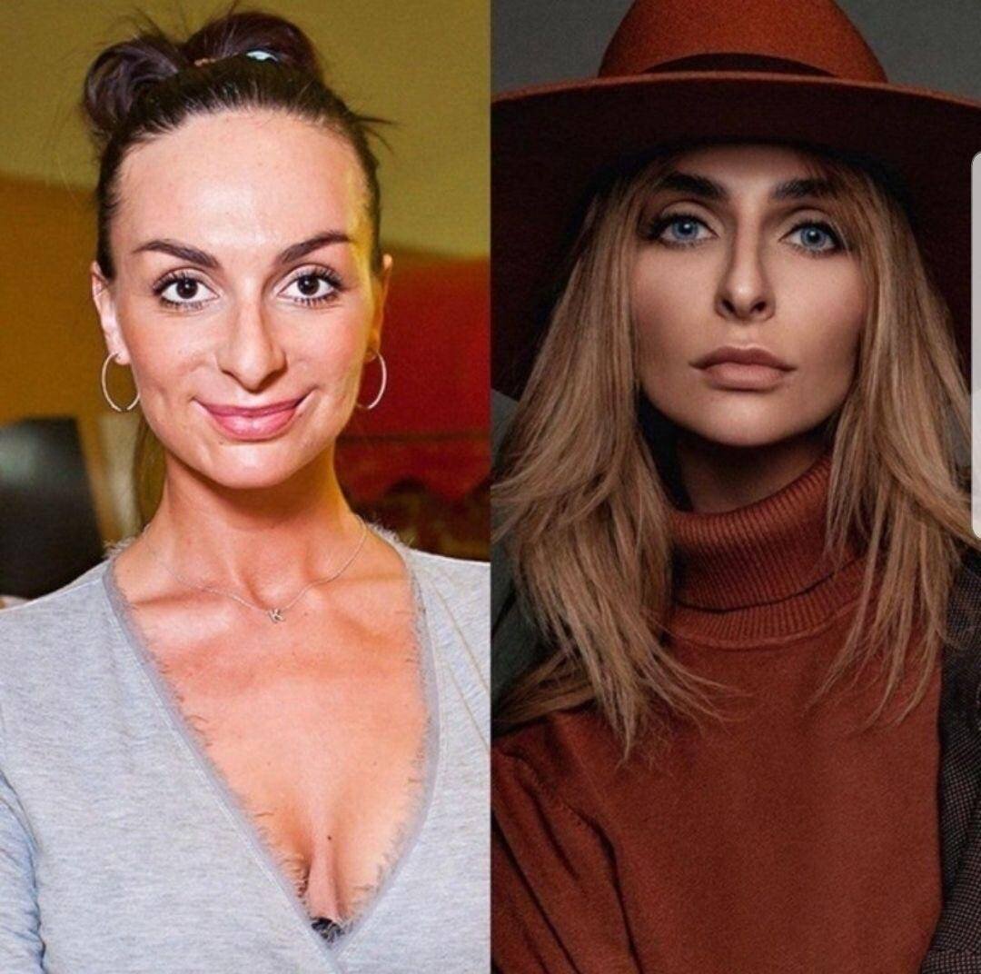 Екатерина варнава до и после фото