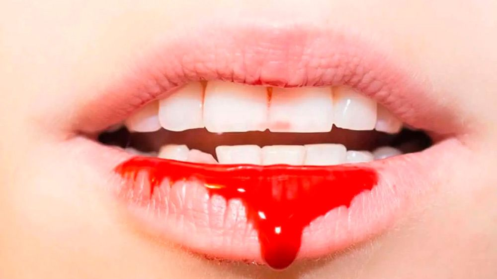 Что означает кровь во рту