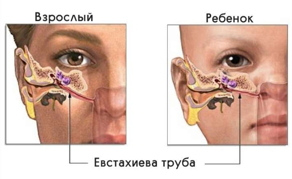 Прозрачные сопли у ребенка - причины и их лечение