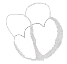 Схематичное отображение возбуждения по сердцу в норме при синусовом ритме