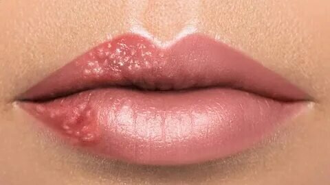 Видна, даже грамотно "замазанная".