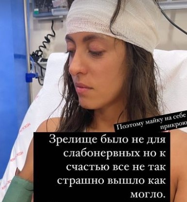     Актриса получила серьезную травму головы фото: соцсети
