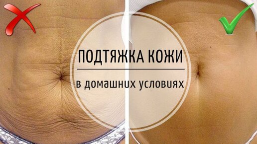 Крем для подтяжки кожи лица Christina Silk UpLift Cream купить в Киеве с доставкой по Украине