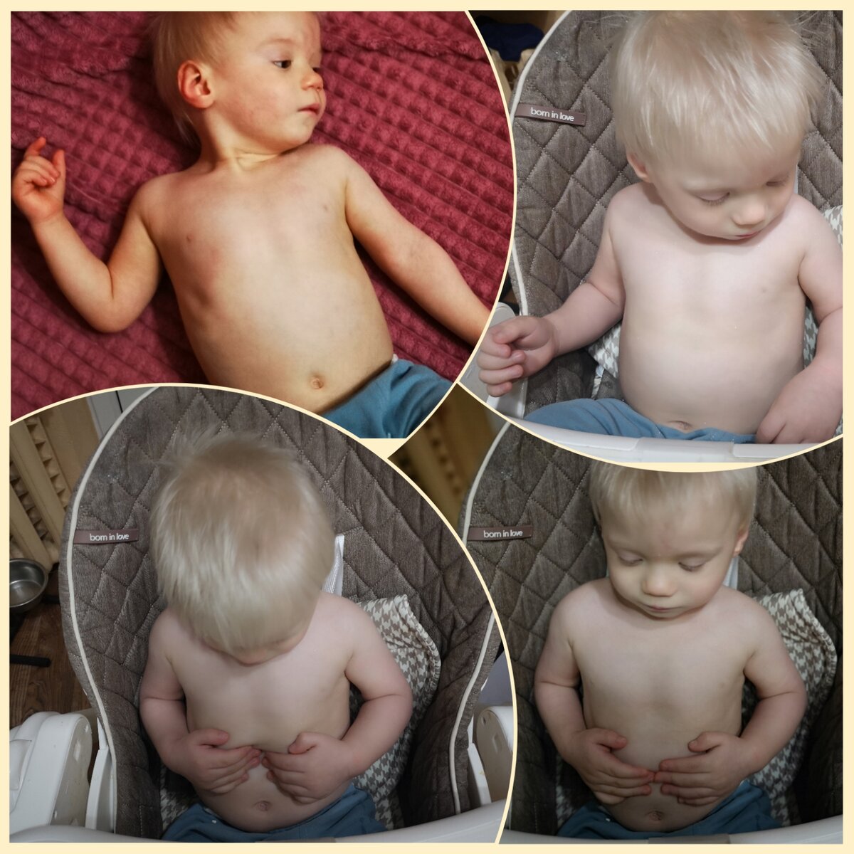 Серёжа через несколько месяцев после дома ребёнка. Набирал по 1 кг в месяц, благодаря правильному питанию и режиму кормления