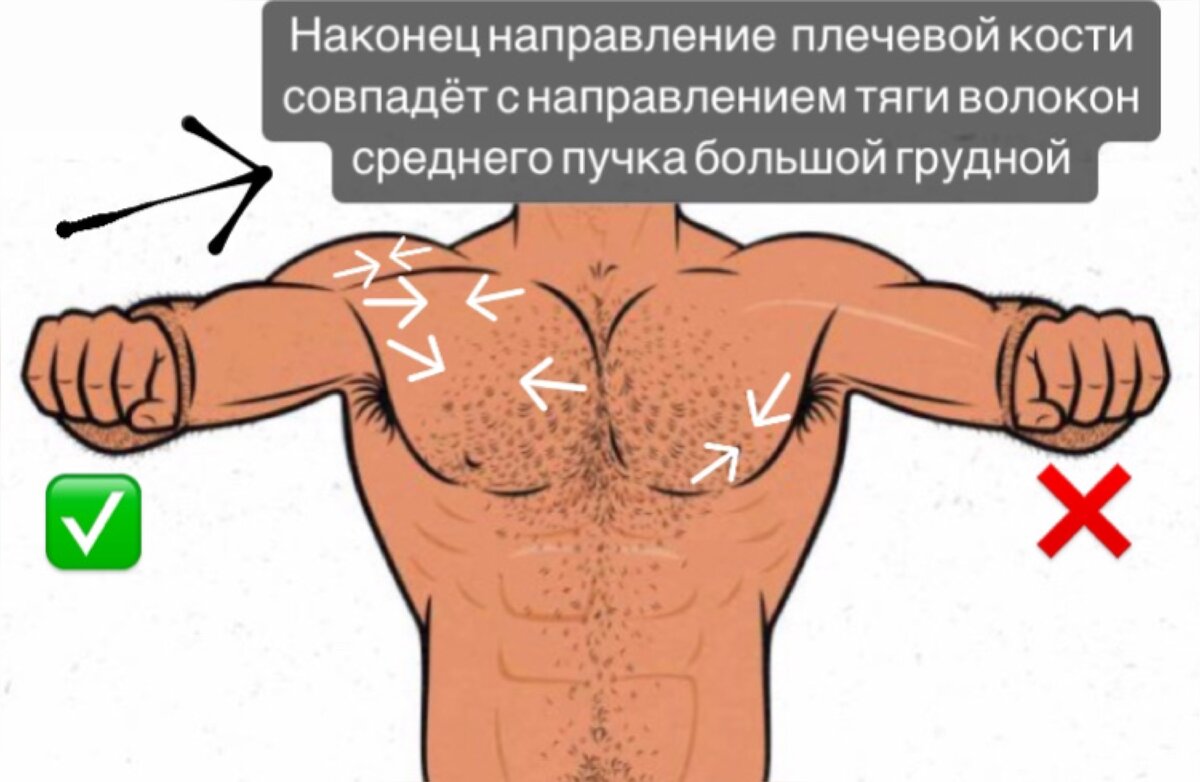 Почему лежа болит плечо. Отжимания на верх груди. Не чувствую грудь при жиме лежа. Упражнения ни середины грудных. Аппликация для болей верх спины.