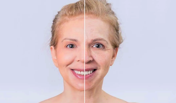 Синдром сахарного лица: проверьте, есть ли у вас этая проблема