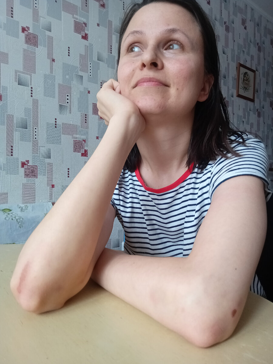 Думаю, завтра локти будут ещё краше)))