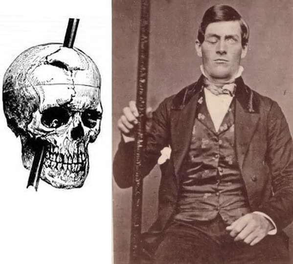 финеас гейдж