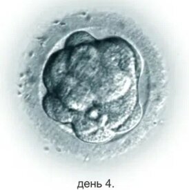 Единственный четырехдневный эмбрион, который развивался и ждал меня в клинике.